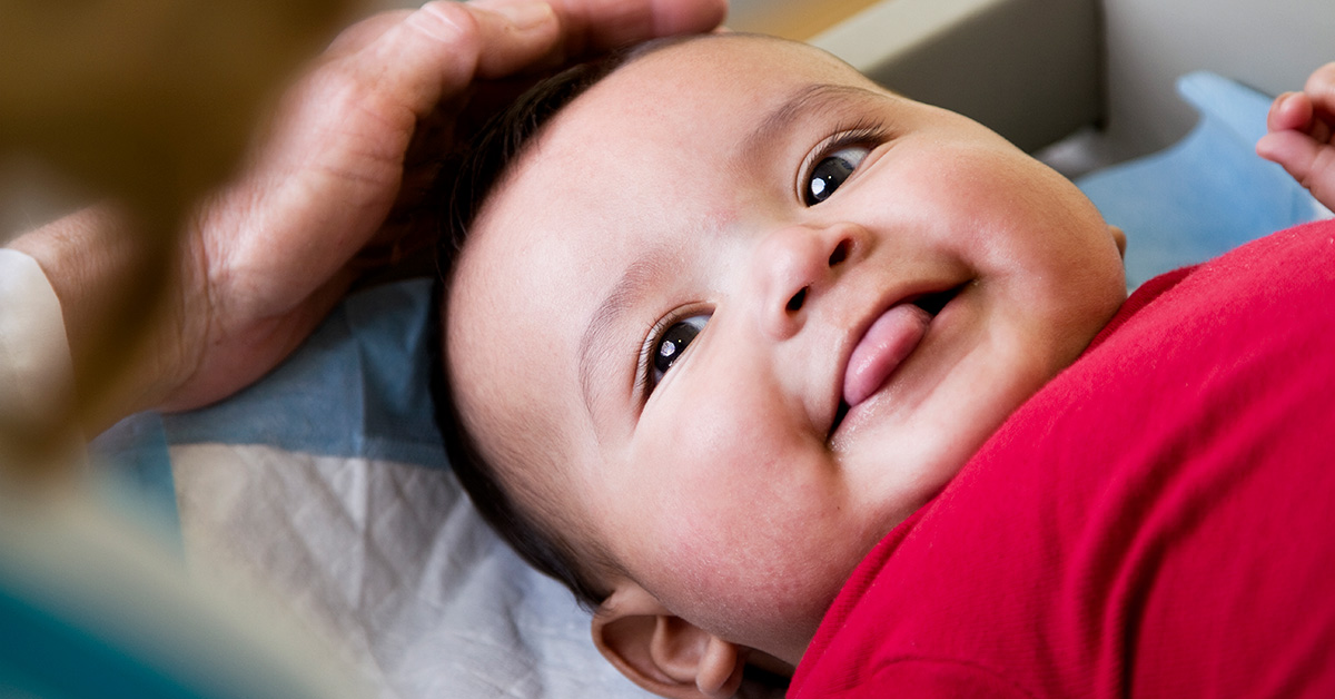 what does it mean when a baby has a tongue or lip tie