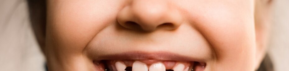 how to know if your child should see an orthodontist