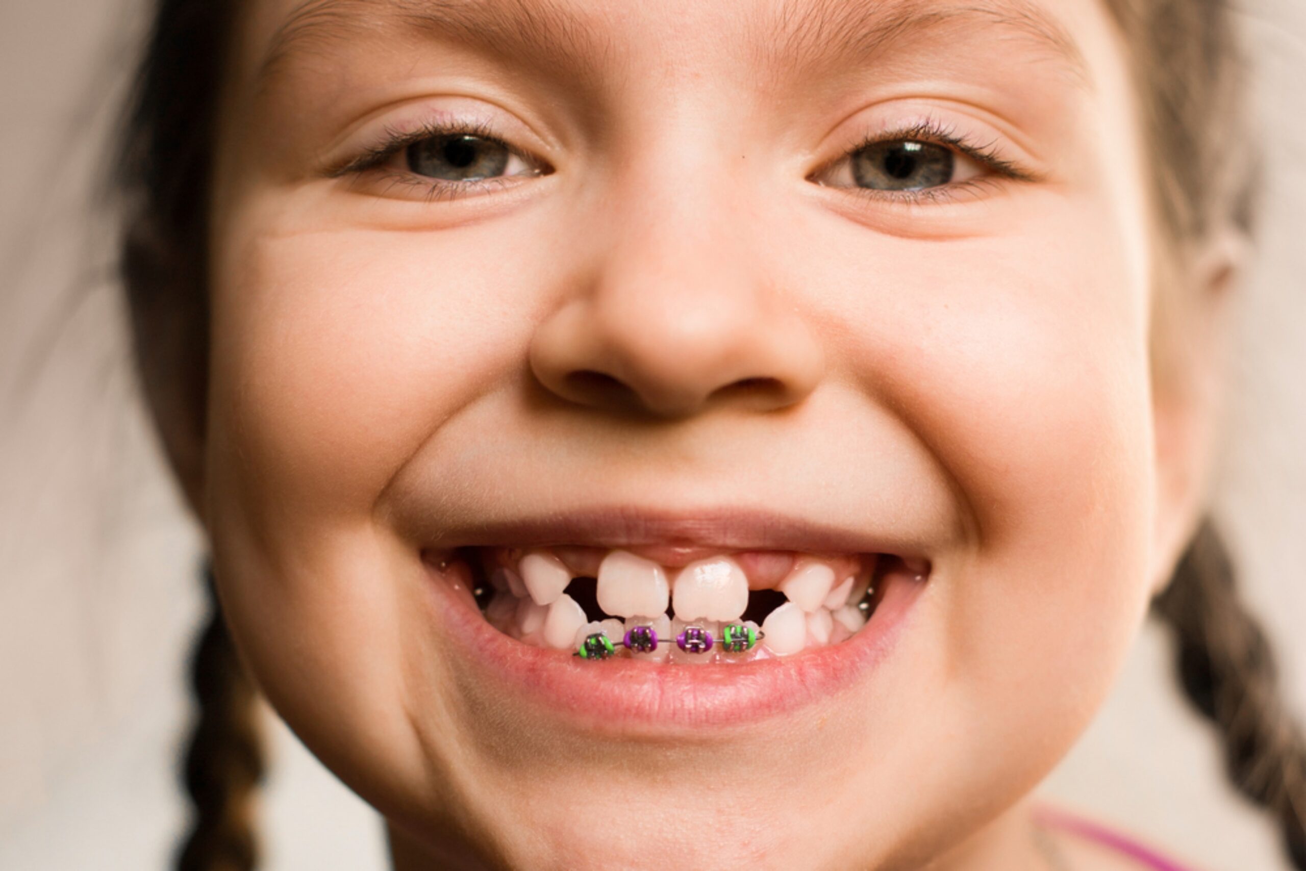 how to know if your child should see an orthodontist