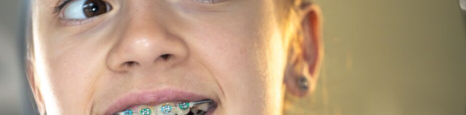 how early orthodontic treatment helps fix bite problems in children