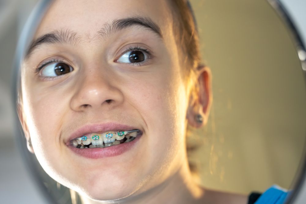how early orthodontic treatment helps fix bite problems in children